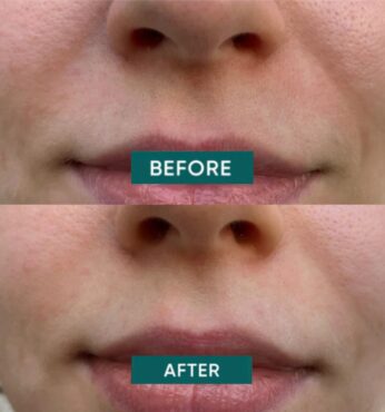 Mouth_Patches_mini_4_988x1056.jpg.jpeg