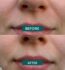 Mouth_Patches_mini_4_988x1056.jpg.jpeg