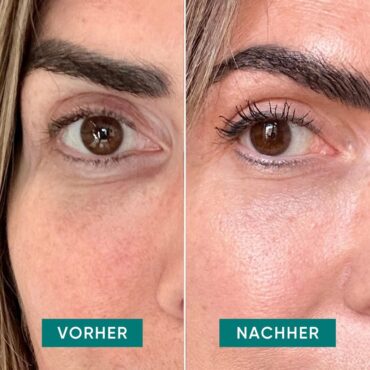 VORHER_1024x1024.png.jpeg