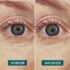 APRICOT_Website_Produktbilder_Eye-Pads11_1024x1024.jpg.jpeg