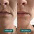 APRICOT_Website_Produktbilder_Mouth-Pads11_1024x1024.jpg.jpeg